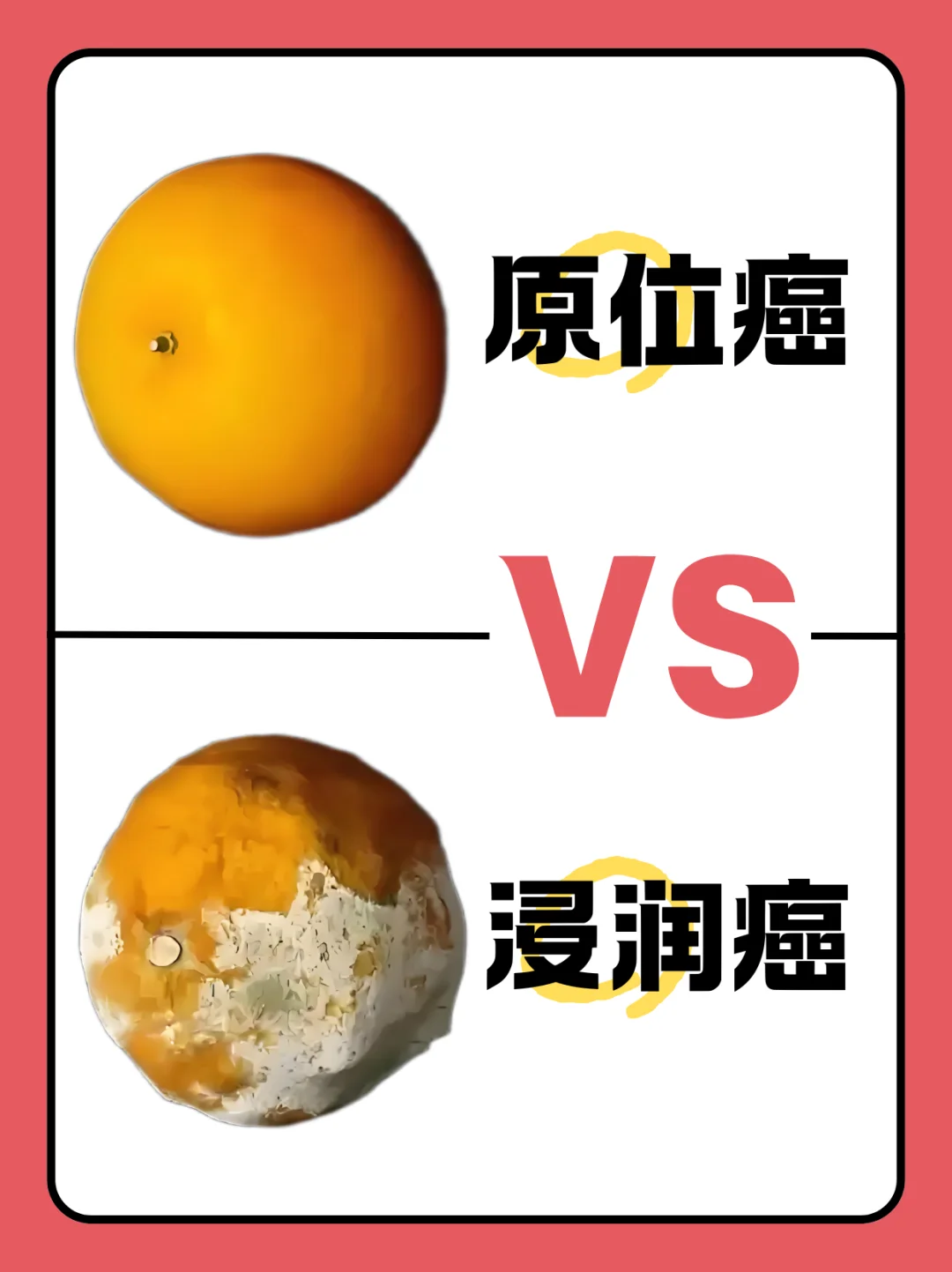 原位癌与浸润癌的区别是什么？