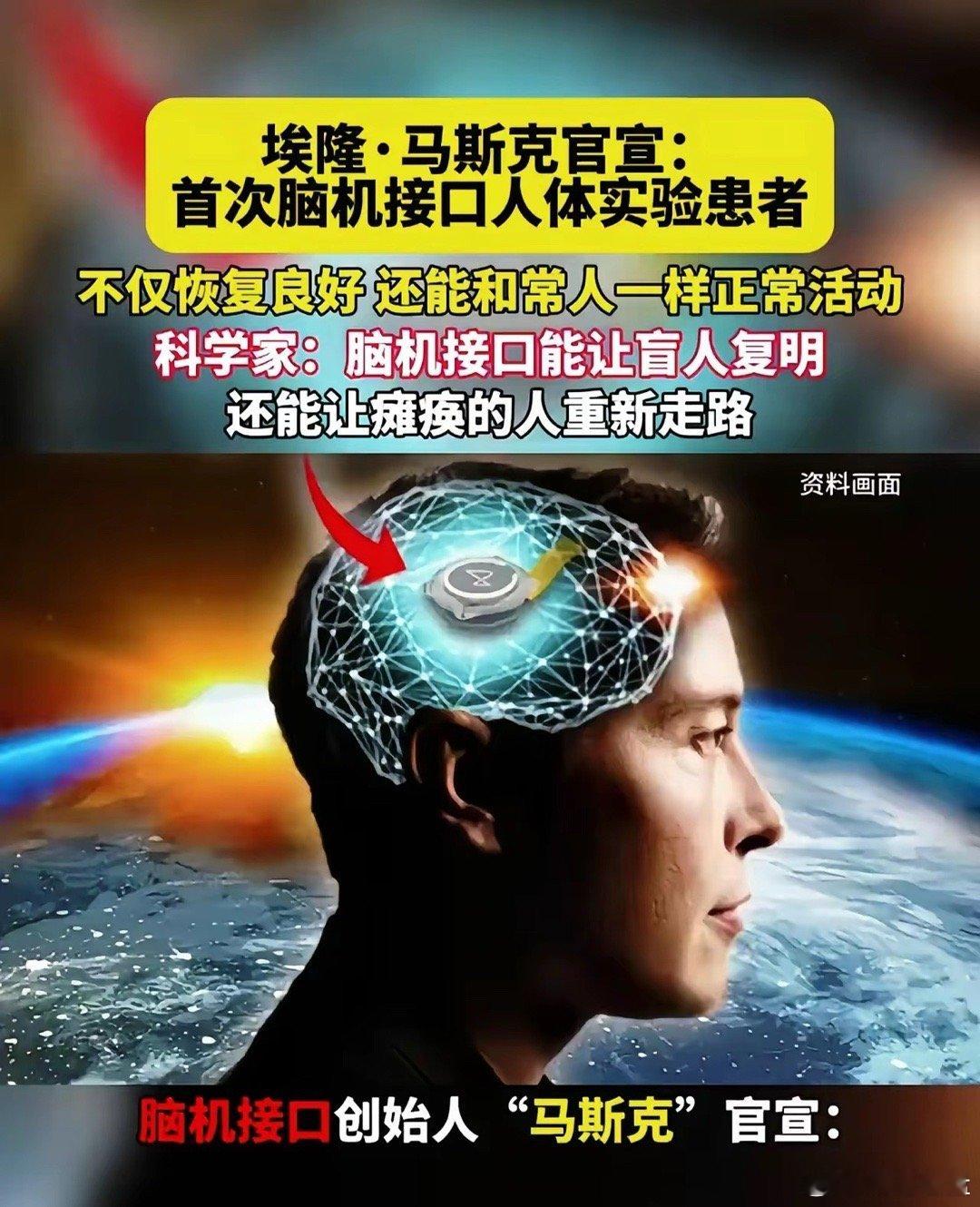 2026年，马斯克搞什么，我就搞什么。跟着巨头的方向走，肯定比自己选择方向更牛。
