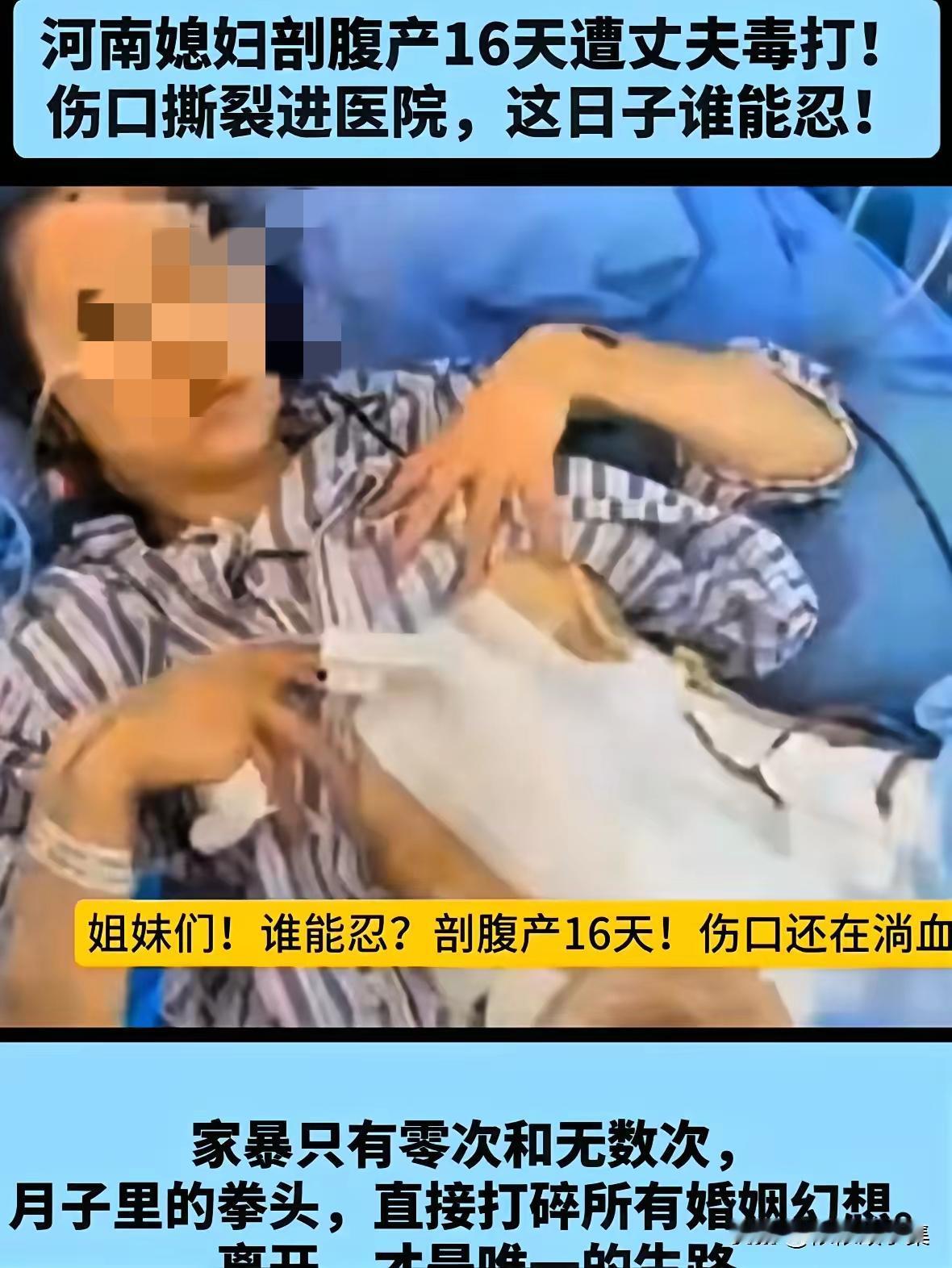 真的要气炸了！剖宫产16天还在淌血的刀口，竟成了丈夫施暴的目标，婴儿啼哭