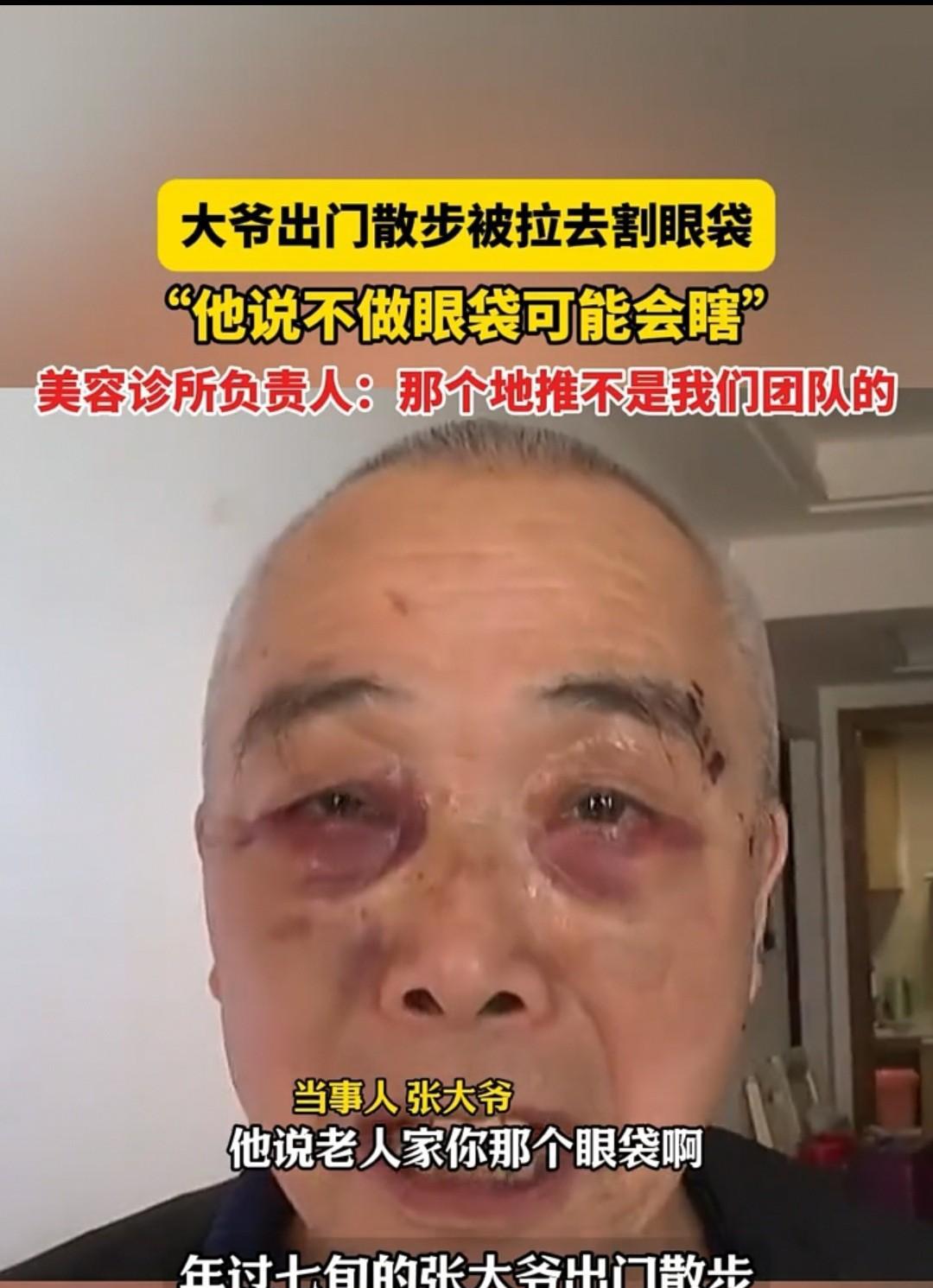 重庆，张大爷70多岁了。因眼袋较大，地推人员对他说：“不做手术会瞎”。最后，张大