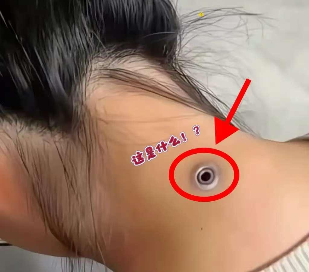 表姐从国外回来找她玩第一眼就被她脖子上的小孔惊到还以为是新潮装饰凑近才发现