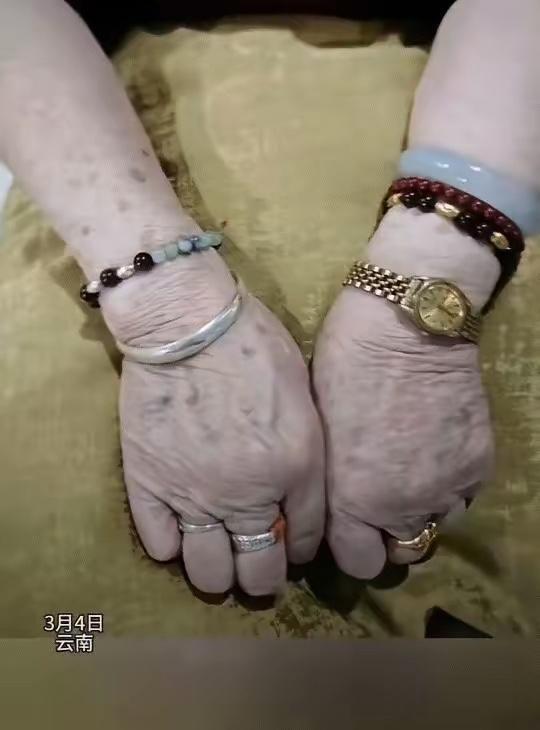 云南，一女子发视频分享，她这天和奶奶聊天时无意间发现，奶奶戴了三十年玉镯的手，和