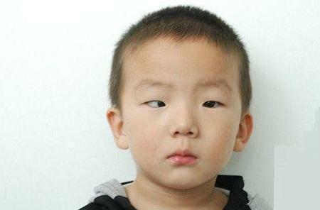 幼童一觉睡醒发现黑眼珠“不见”了, 你还在纵容孩子这样的习惯吗