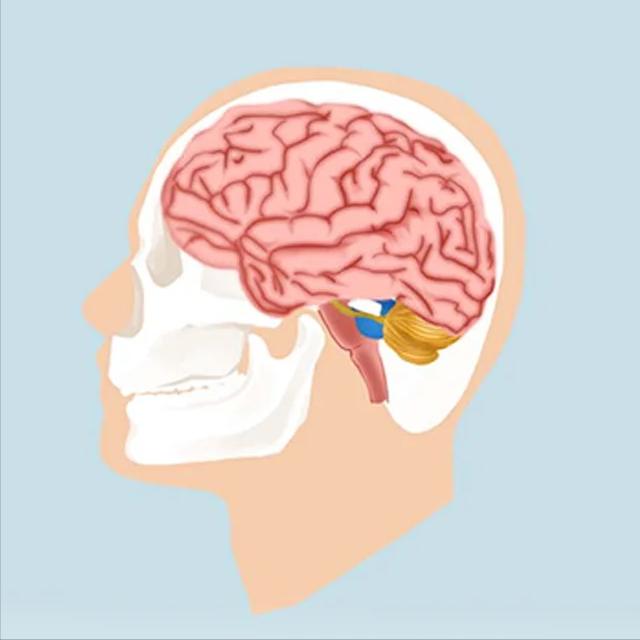 脑梗恢复必备的5个好习惯，大家都说太重要了！1.饮食管理要做到位脑梗患者需要