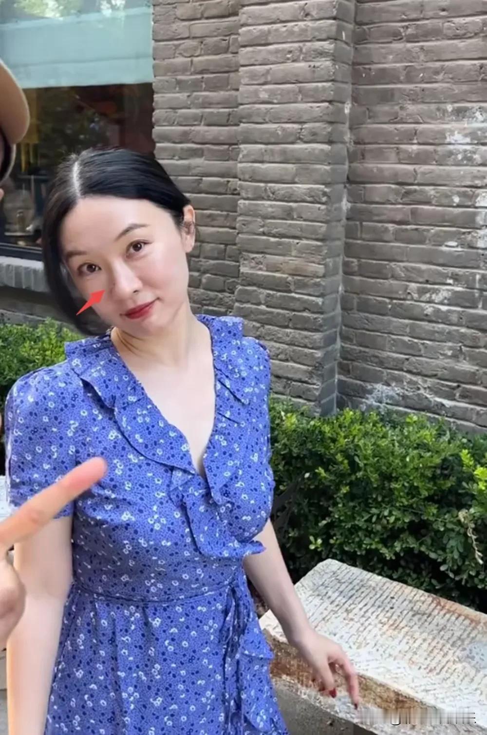 网友在北京偶遇霍思燕，霍思燕瘦了好多，穿着蓝色碎花裙，扎着低丸子头，素颜朝天看起