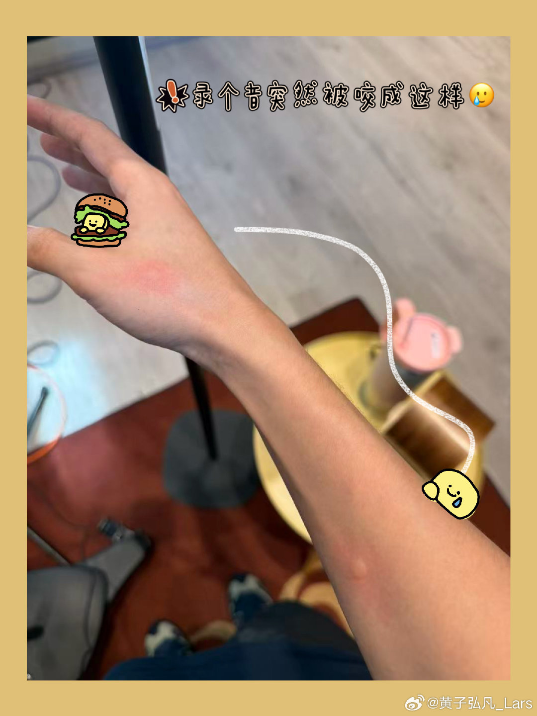 不得不提起在贵阳6个人里只咬我一个的故事了，在贵阳保守估计被咬了六七个转载了的微博图片​