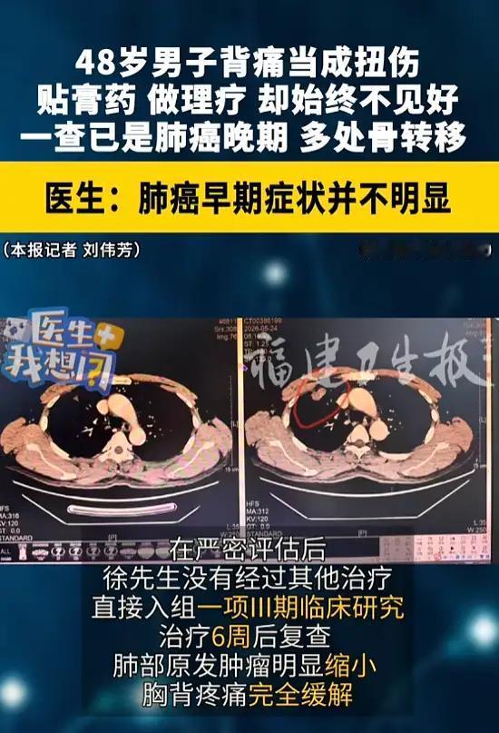 “千万别把身体当铁打的！48岁大哥一查就是晚期，这‘忍功’差点要了命！”8月
