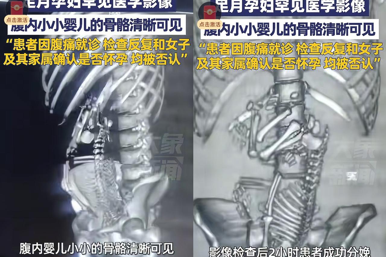 惊到汗毛竖！19岁女孩腹痛蜷着进急诊，疼得说不出话，医生却盯着家属反复问一个问题