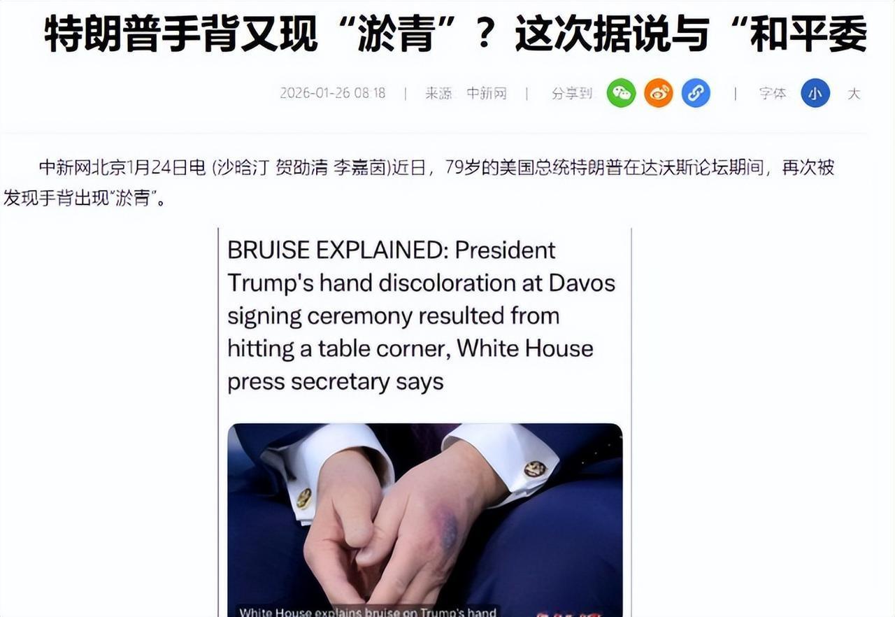 这一回，那个不可一世的特朗普恐怕真的撑不住了！就在短短48小时内，坏消息接踵而至