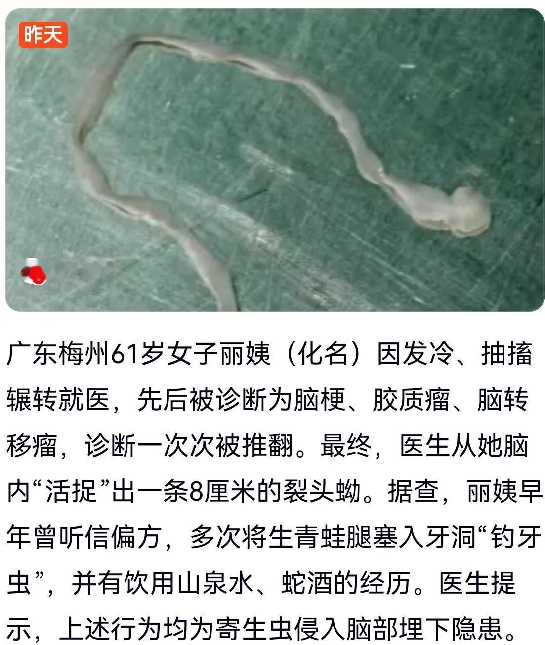 广东梅州61岁的丽姨（化名）最近经历了一场犹如悬疑片般的就医历程。最初身体出现发
