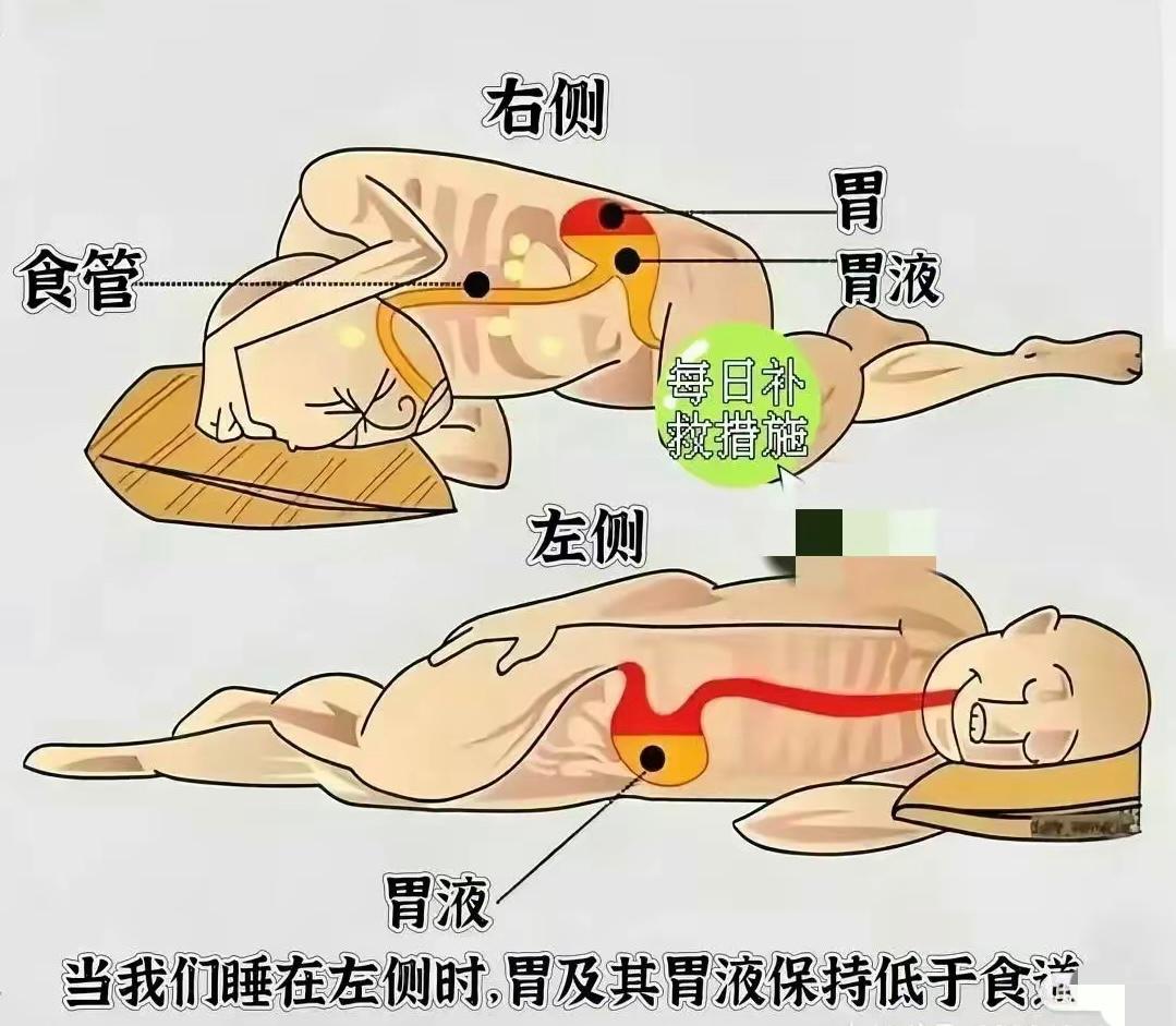 原来睡觉也有正确的说法？看图示我是这样理解判断的：右侧睡觉对身体不利是因