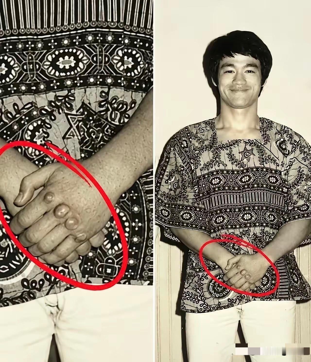 李小龙绝对是有真功夫的，这手一看就是常年练功导致的