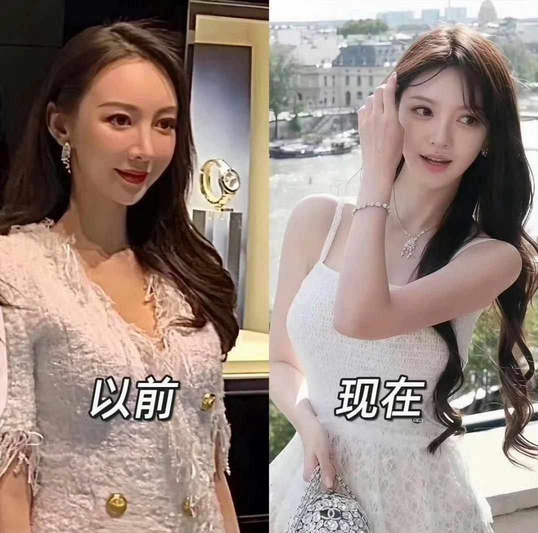 叶珂说自己21岁开始整容原来叶珂从21岁就开始整容，其实原来挺好的呀，有自己的