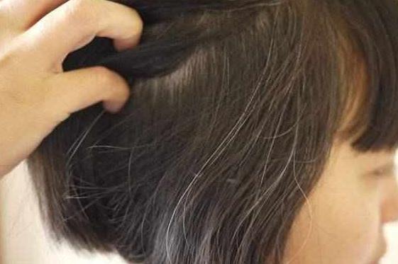 少年白头是什么原因？怎么样预防白发？ 你有没有过这样的经历？一早起床，走到镜