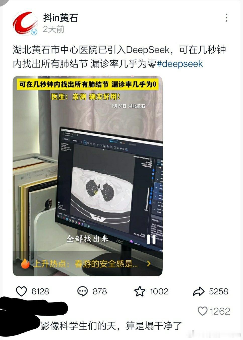 🔻部分医院开始接入DeepSeek系统了，医学生的天塌了。可以在几秒钟内找出所