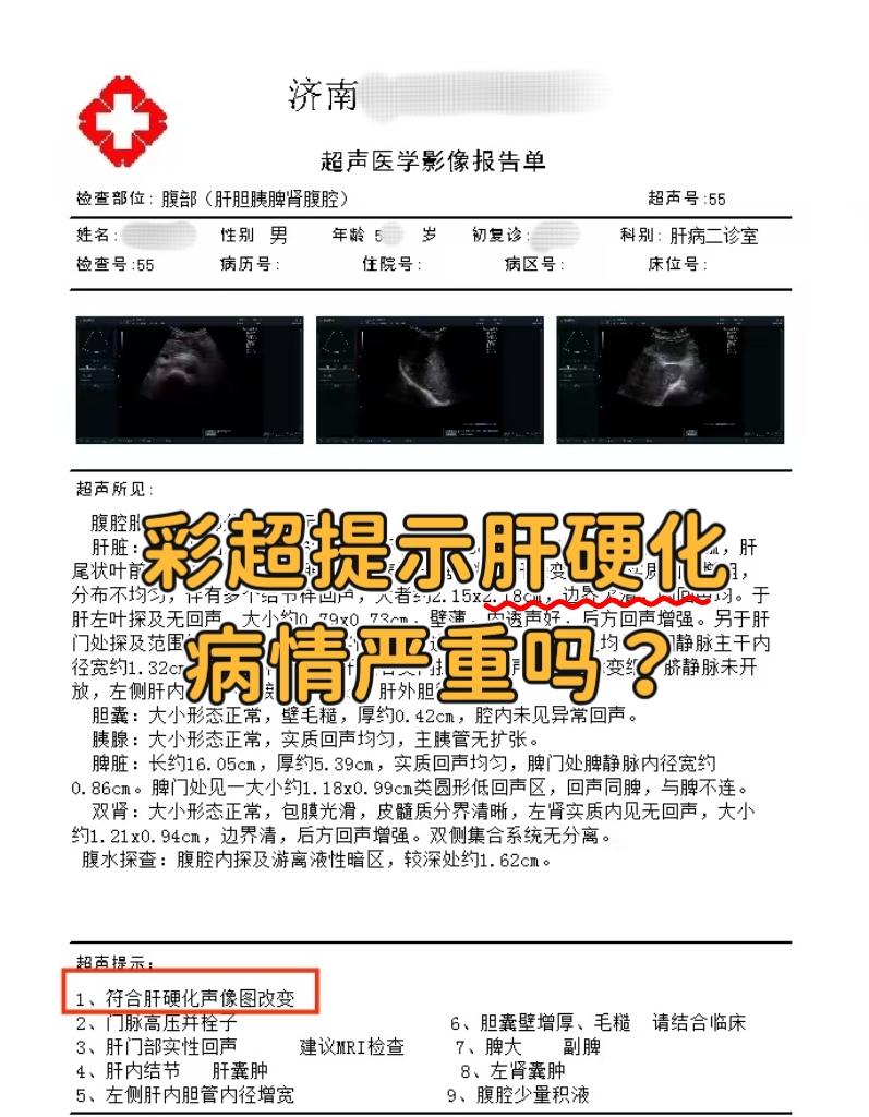 彩超提示肝硬化不能说不严重，肯定是比单纯肝炎损伤要严重，但病情严重程度...