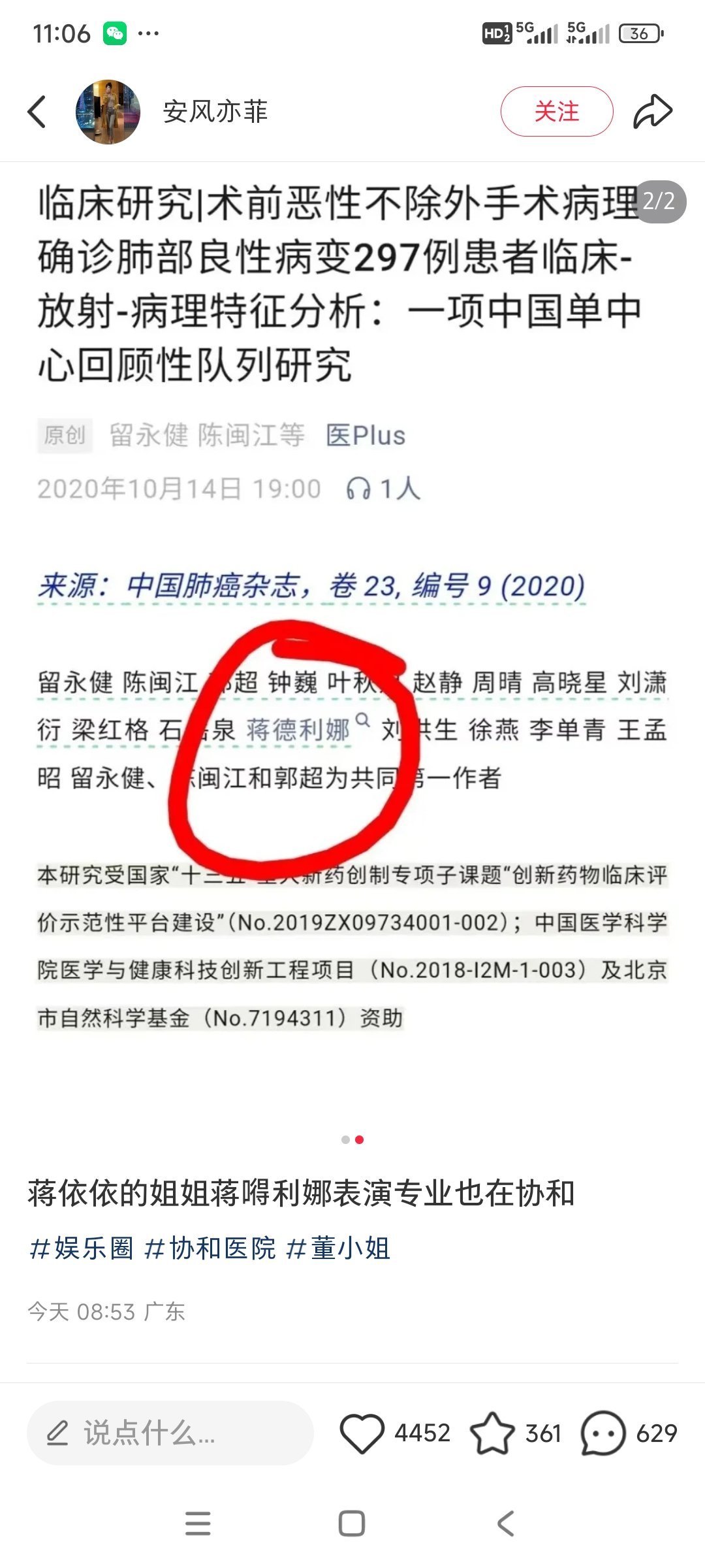 协和医院有个叫蒋德利娜的，曾经作为共同第一作者发表了一篇关于肺癌的文章。演员蒋依