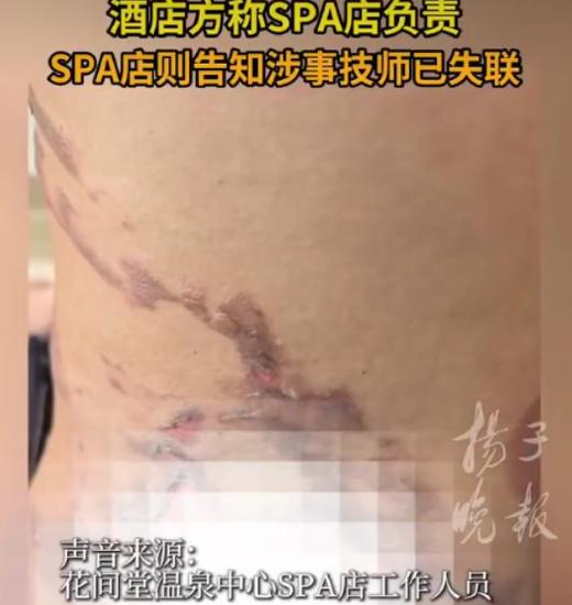 湖北，女生跟朋友去酒店里开房，办理好入住后，女子准备去酒店的养生馆做个spa。谁