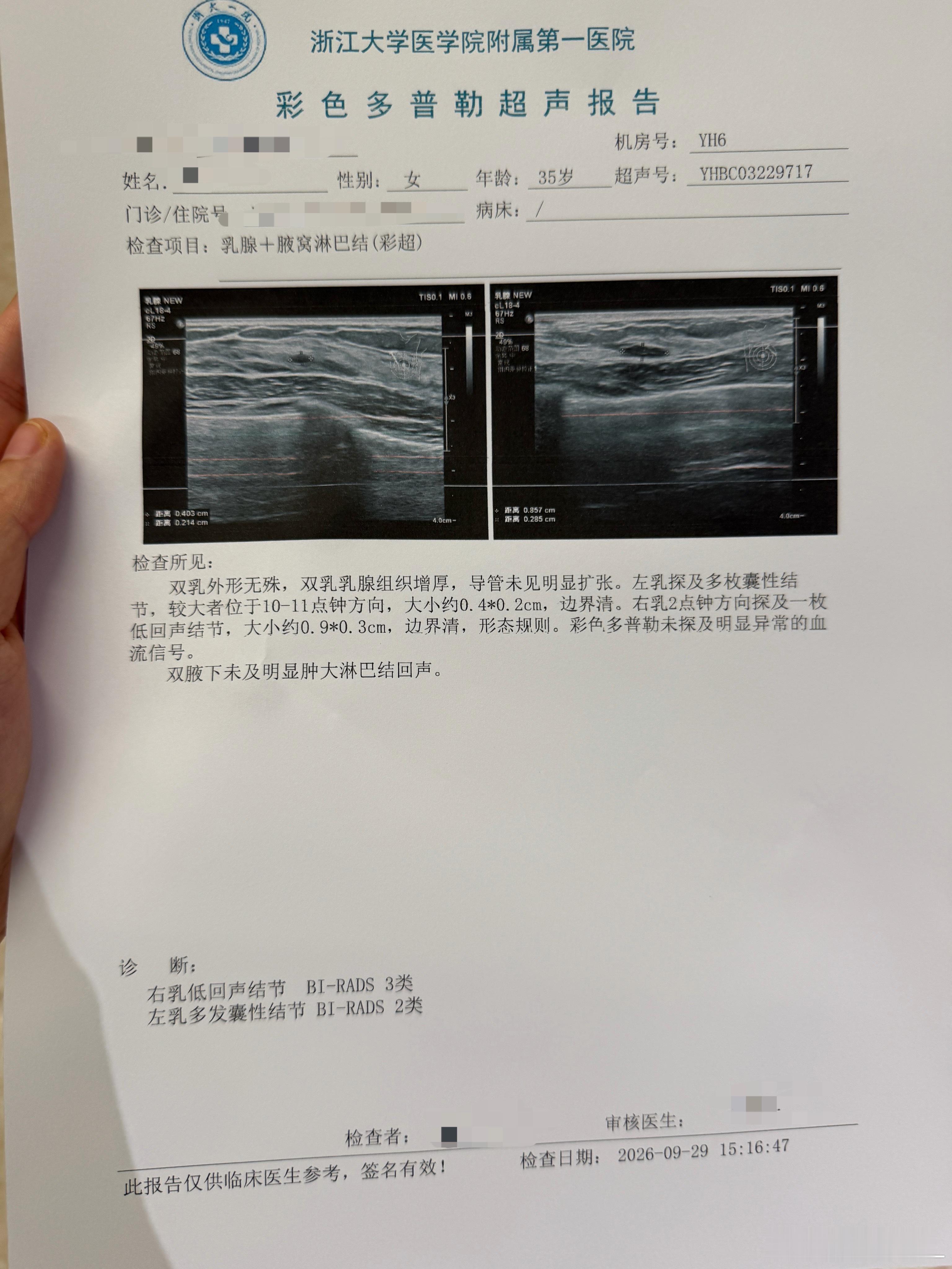做B超的时候听到医生说右乳多发囊肿，左乳又多了一颗结节，心都死了报告单打出来，看