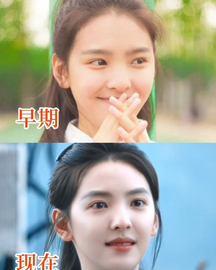 不是章若楠都有人说她整容？我印象中她是出了名的纯天然啊