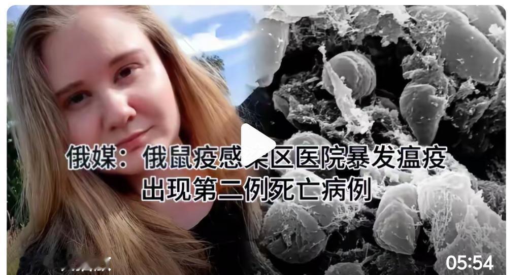 俄罗斯这事件如果不能控制，在国内漫延，对俄罗斯来说问题就很严重了。一边在和乌克兰