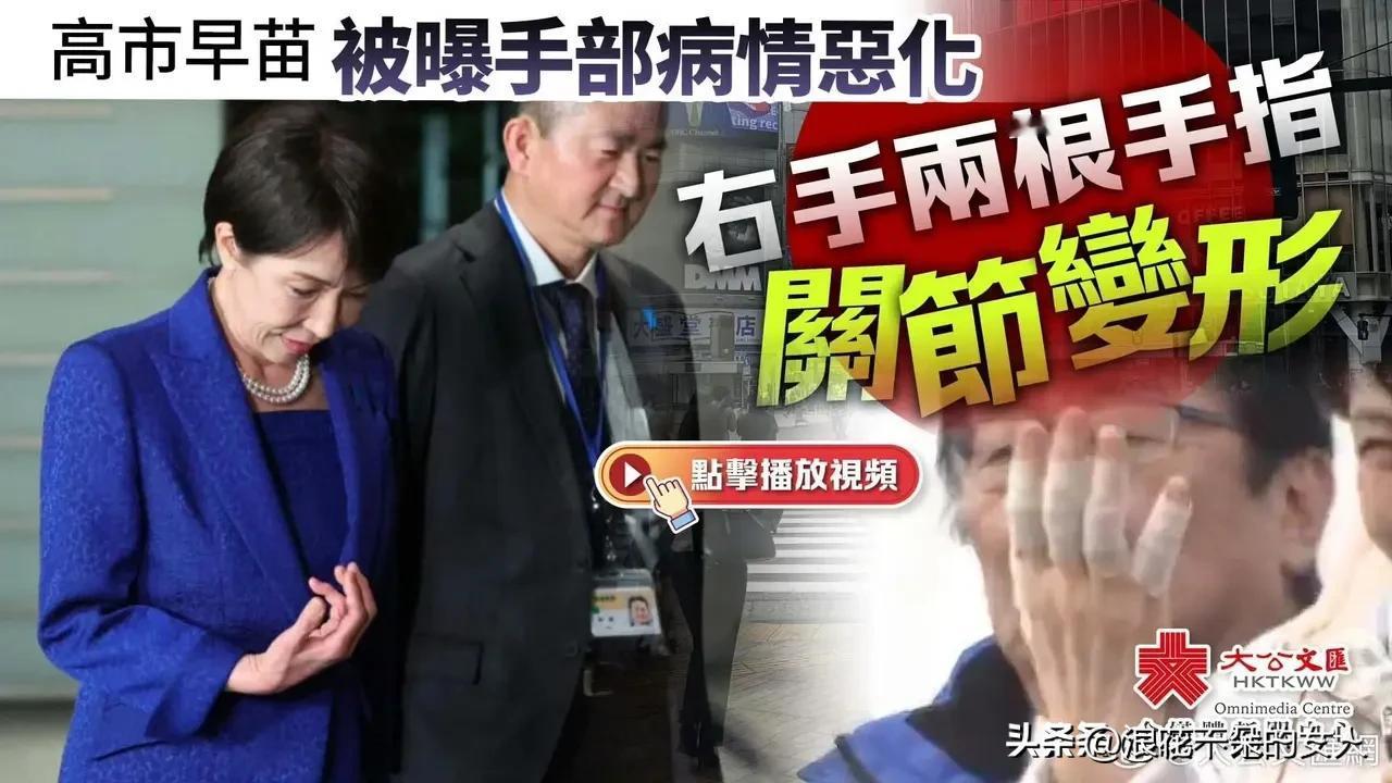 是这样的，随着人工智能的发展，AI看病诊疗已经非常厉害了，如果你还不知道高市早苗