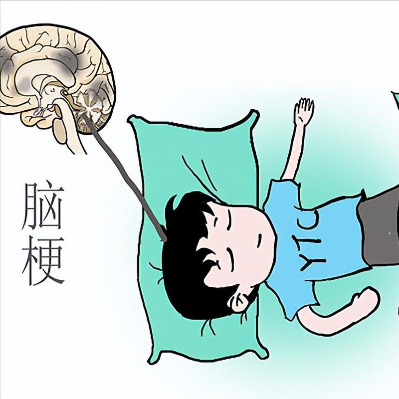 身体出现这3个表现，可能是脑梗在逐渐恢复！ 1.头痛症状减轻若是明显感觉