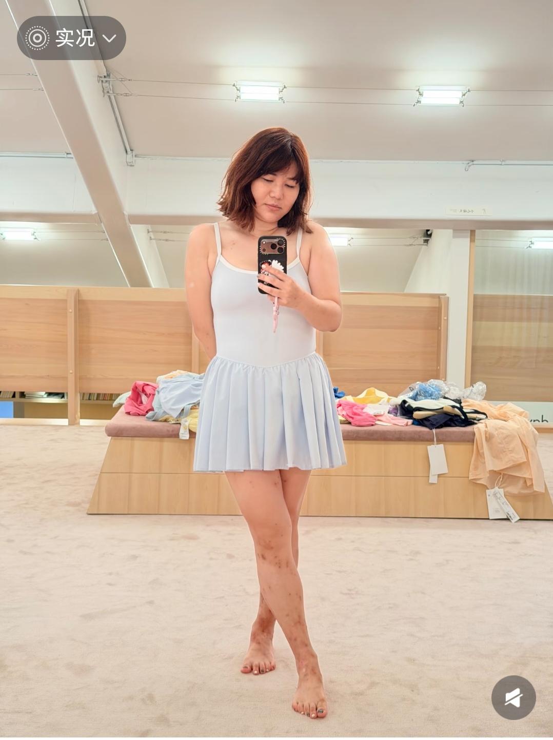 我的天啊，杨天真的腿这是怎么了，看着好不舒服。