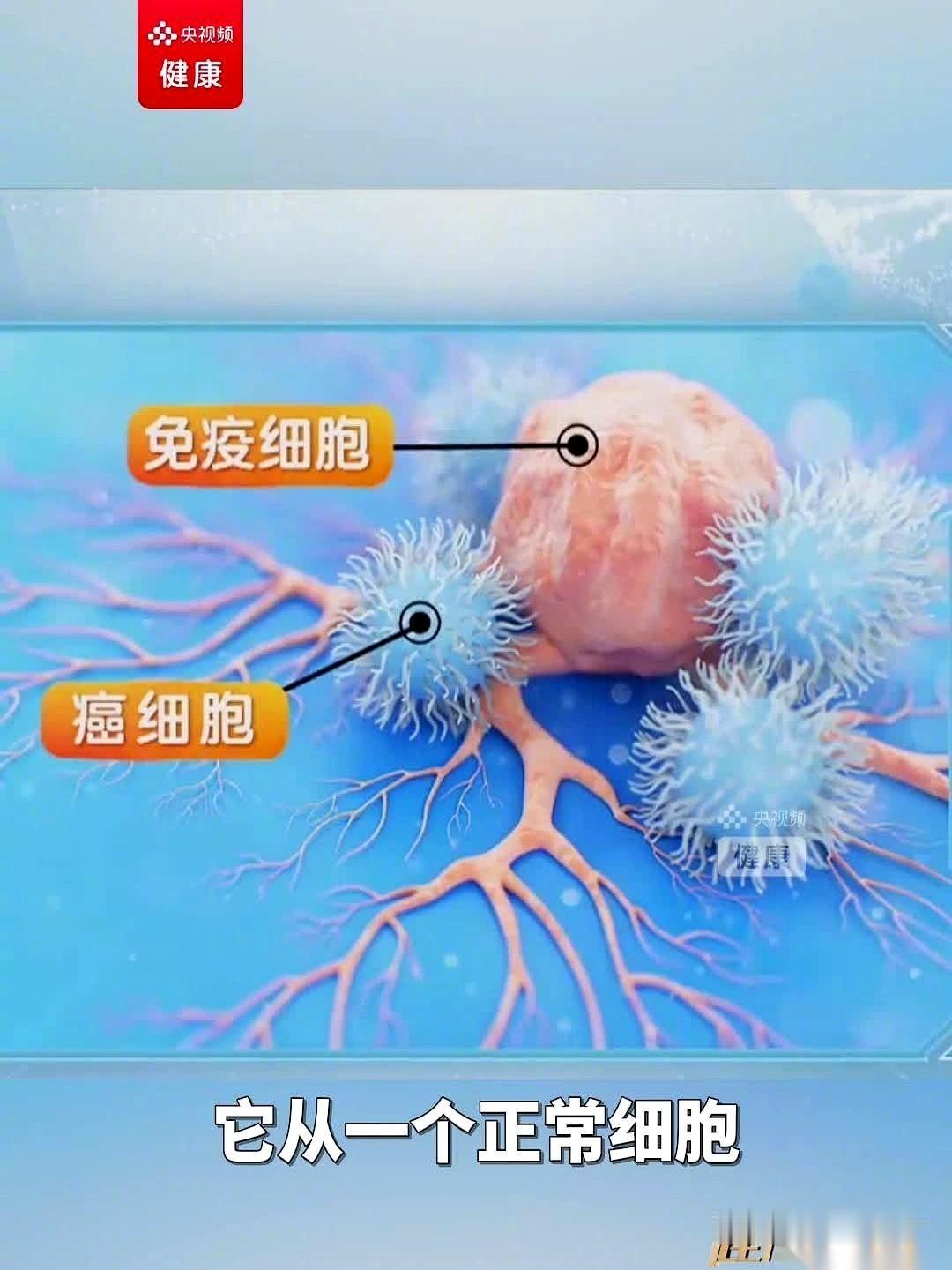 我今天看到一条新闻，手都凉了。说现在死亡率最高的恶性肿瘤，它最开始的温床，可能