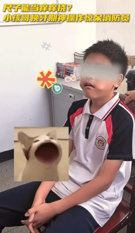 这下全国人民都知道你顽皮了。湖南一10岁男孩把三角尺塞进嘴里拿不出来了，不得已