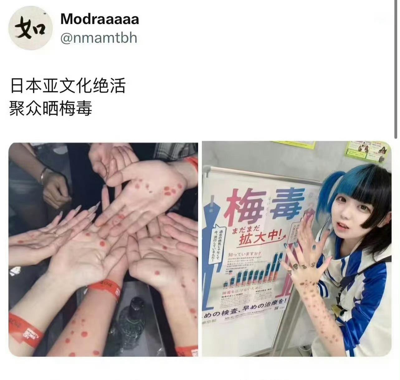 日本梅毒扩散日本年轻人聚众晒梅毒什么狗屁文化，就是有大病。