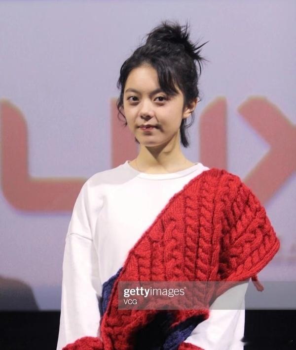 麦麦好像一直以来眼袋都特别重