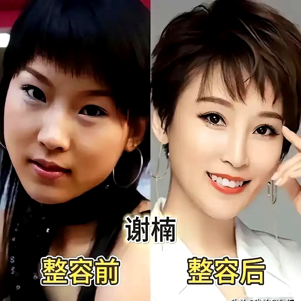 王心凌靠着甜美嗓音和元气舞台火遍大江南北，哪怕关于整容的传闻传了多年，本人从没承认过。翻翻她早年照片