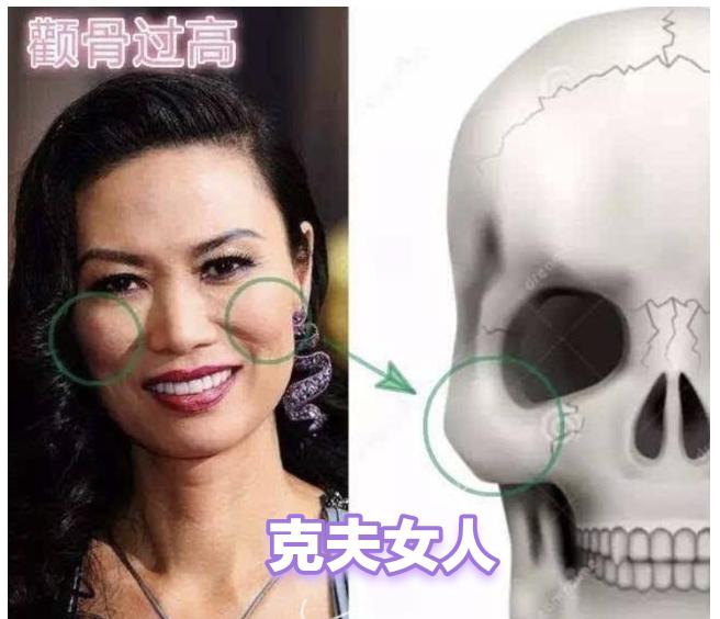 （原创）什么样的女人克夫？1、颧骨高的女人。俗话说颧骨高，杀夫刀，颧骨高的女