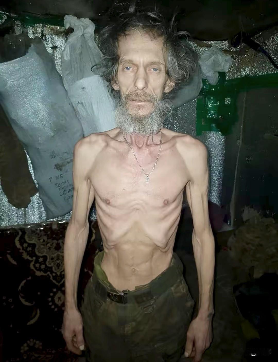 实拍画面曝光！乌军前线士兵饿到皮包骨头，补给彻底断裂近期顿巴斯前线实拍画面