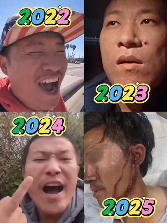 甜甜圈润美这四年。希望王伟恒这次被打之后要明白一个道理，美国流浪汉的寿命一般也就