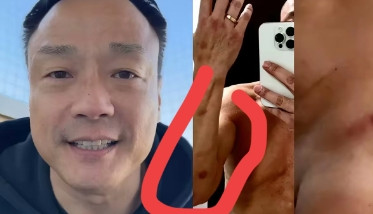香港艺人王喜，因主演《烈火雄心》而成名，近几日在社交平台上公开了自己的健康检查报