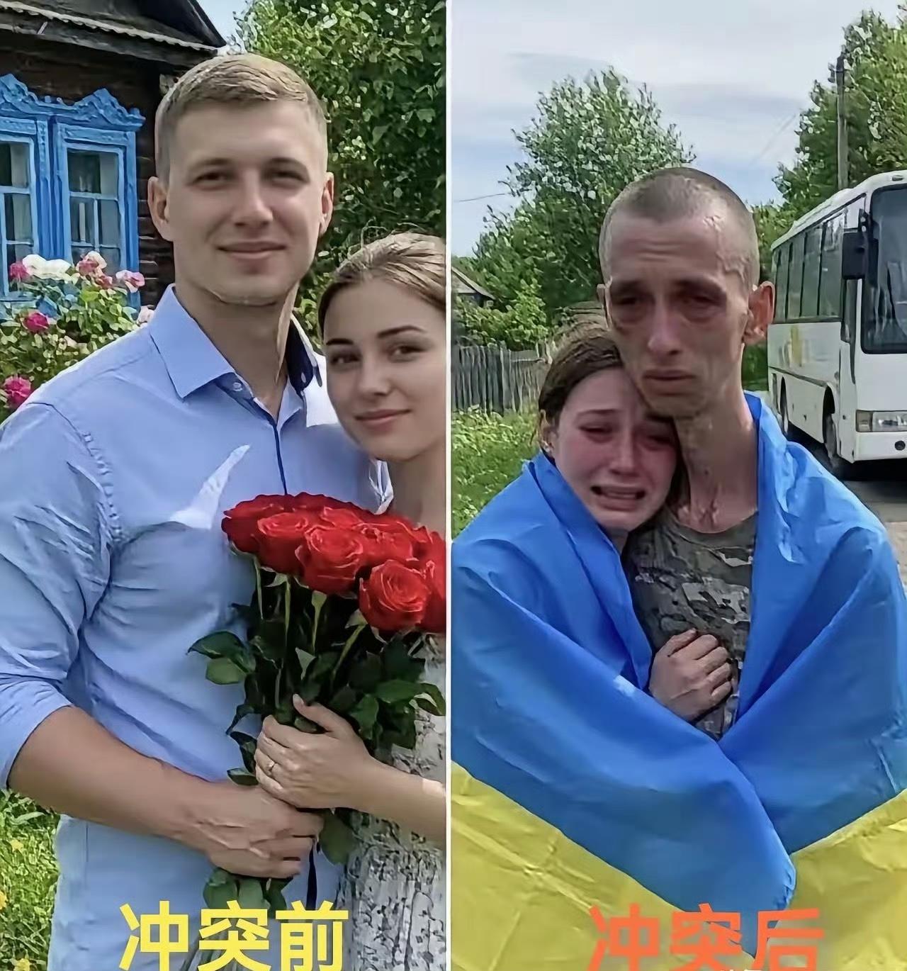 乌克兰被抓壮丁的士兵活着回来了，结果成了这样子。不知道现在的乌克兰人民，看到急