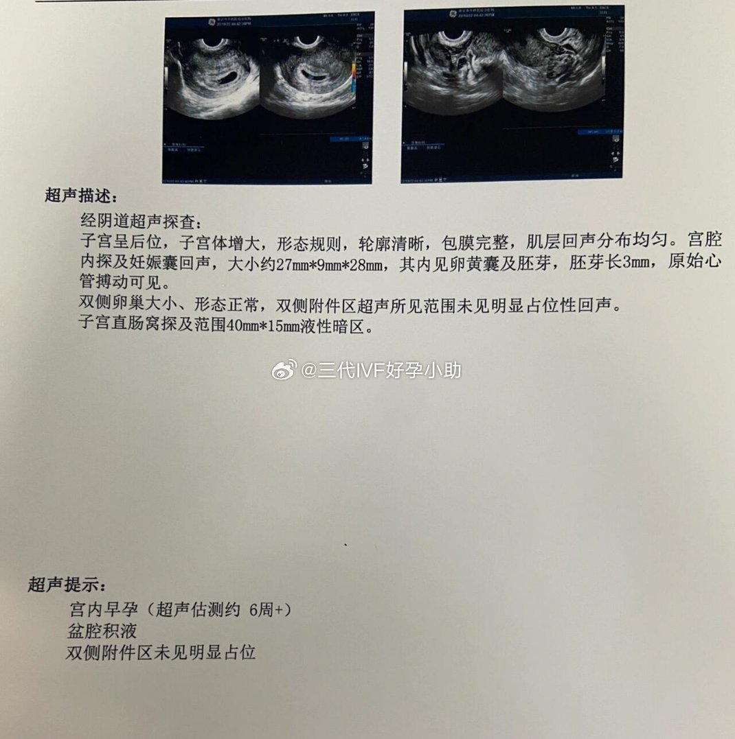 内蒙拉拉家庭二胎来报道啦🎉这对客人是我们的老朋友了。2年前，她们通过三代试管＋a卵b怀，顺利迎来了