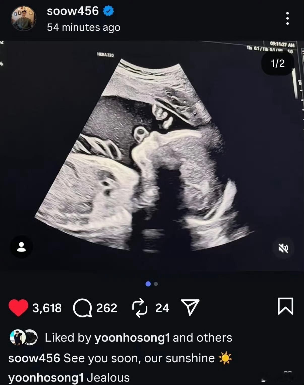 宋承炫宣布当爸还以为宋承宪，这位还真的不认识