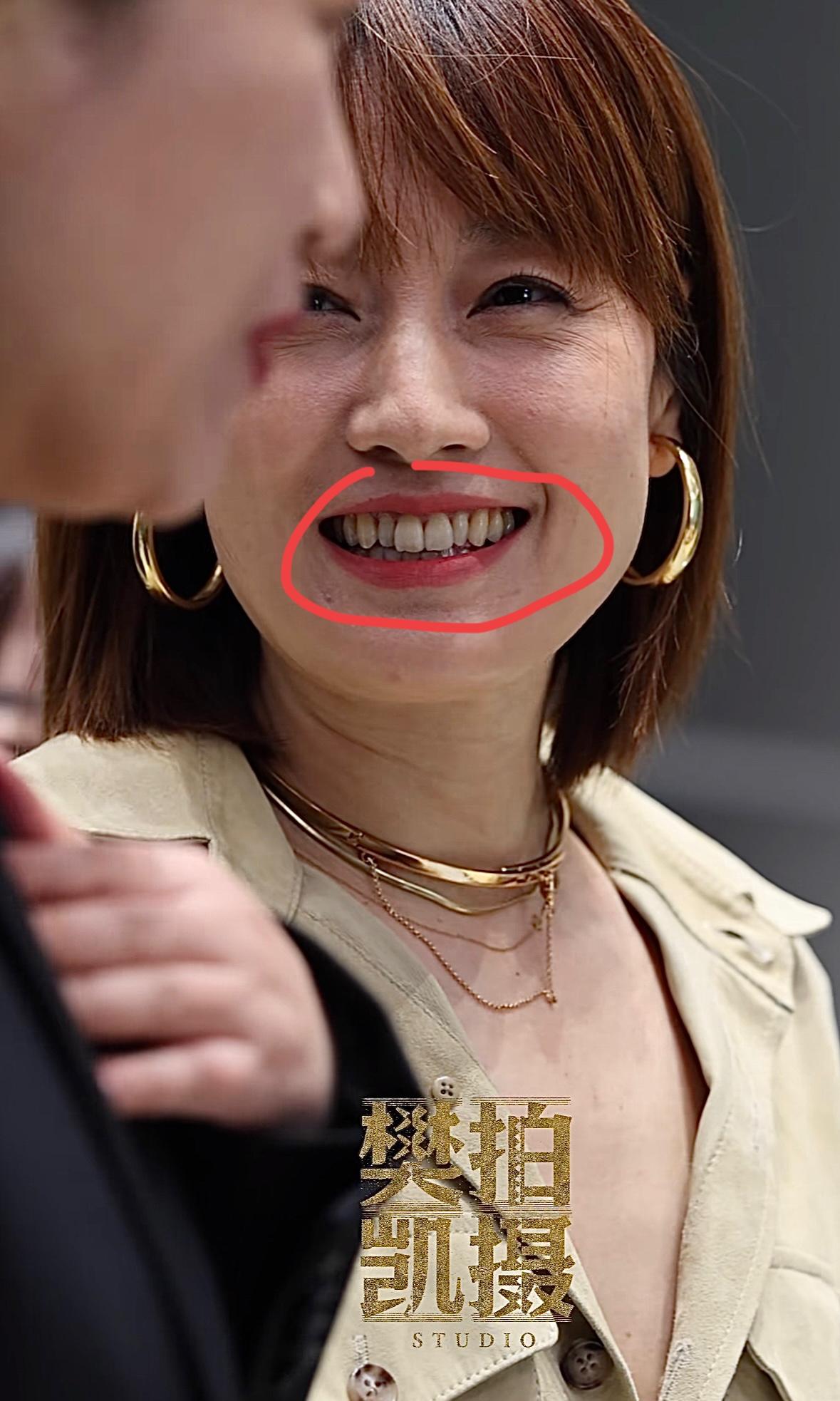 多久没见过女明星有这么黄的牙齿了马伊琍一个快50岁的女艺人竟然活的如此松弛