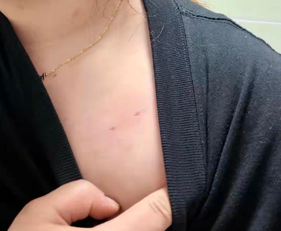 云南昭通，一名女子独自在家洗澡的时候，自己的家门被撬开，一名醉酒男子闯了进来，将