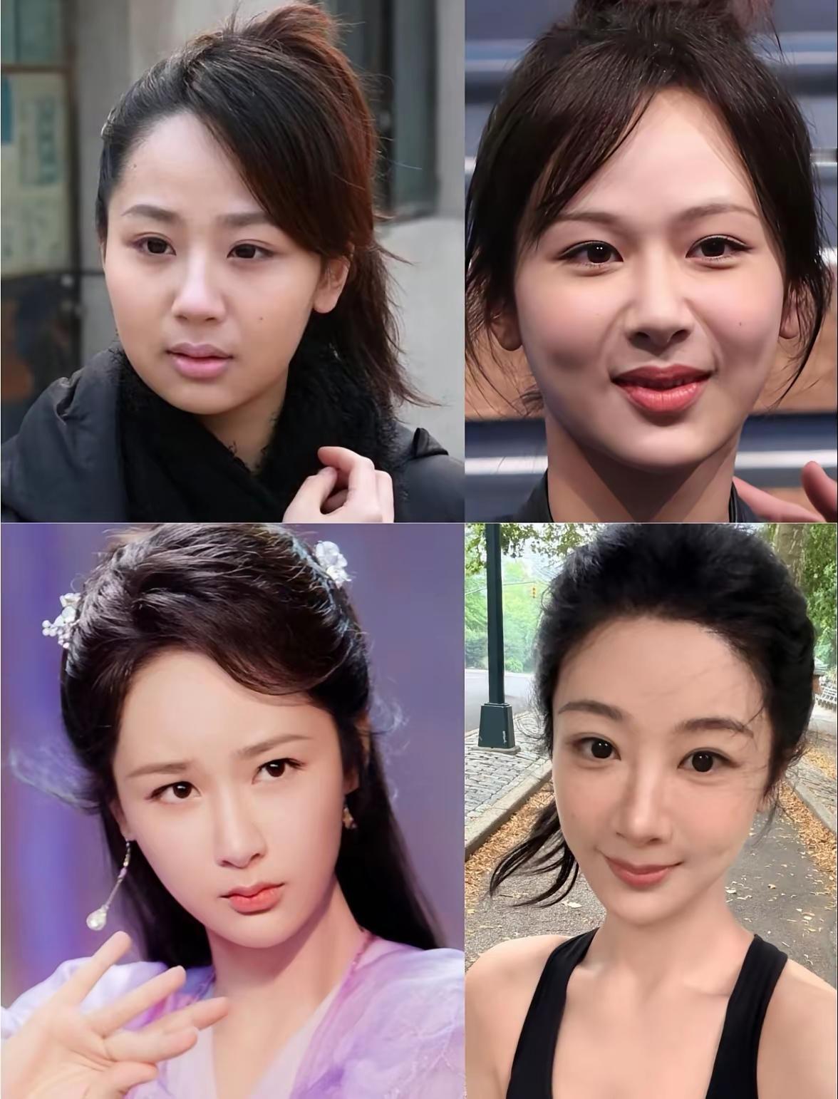 看看杨紫是怎么一步步蜕变大美女的。第一图是粗眉毛双眼皮大眼睛，圆圆的娃娃脸，