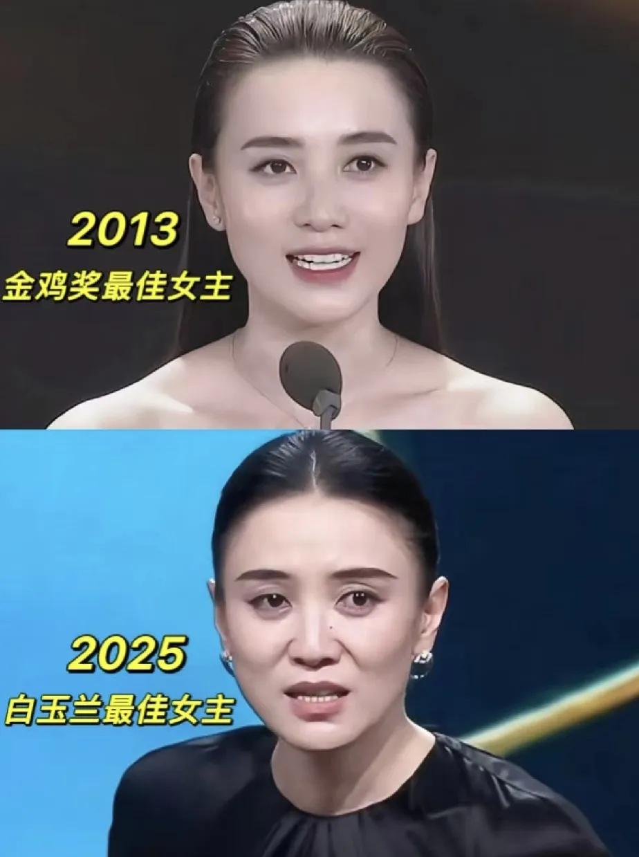 不知你们发现没有，宋佳好像年轻时也看着不年轻，现在更是肉眼可见的老了。不过