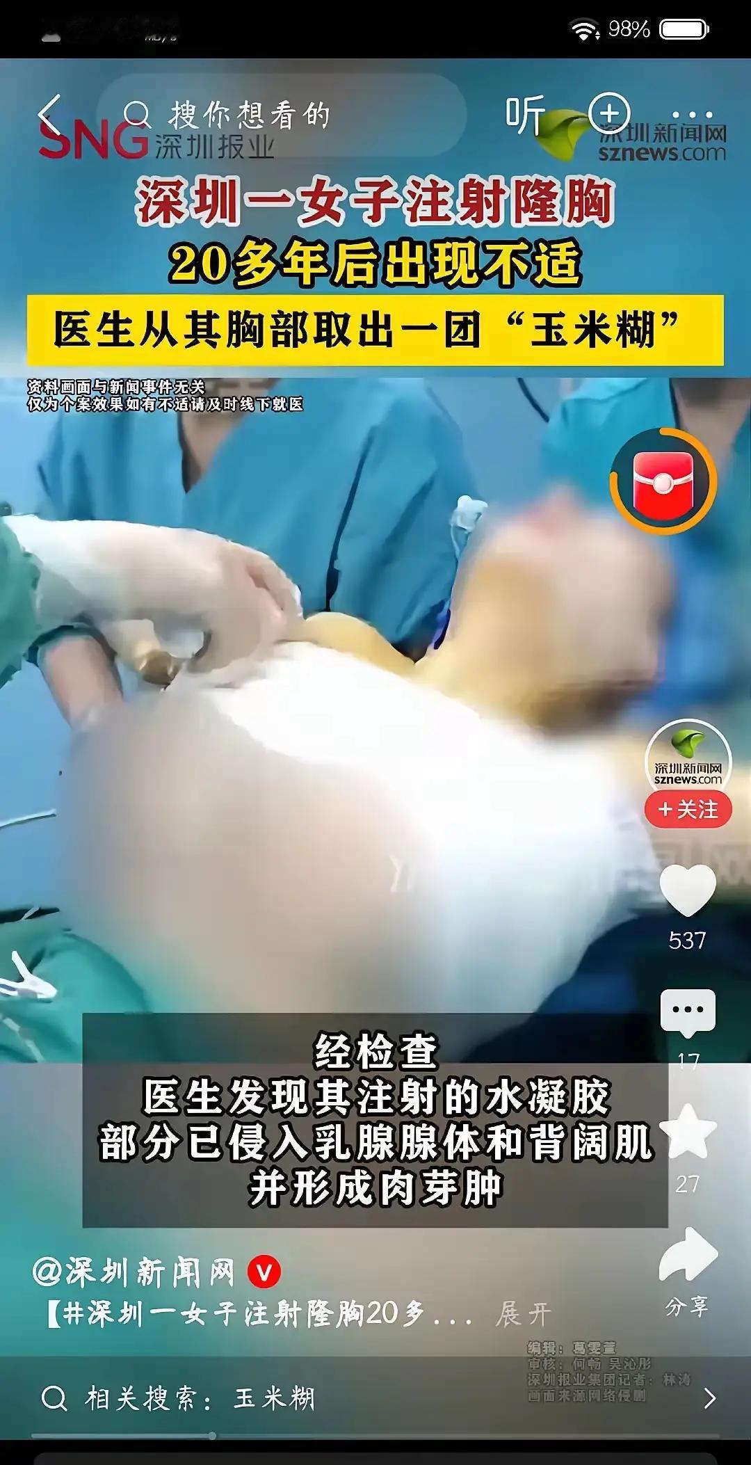 太吓人了，这哪是“变美”，分明是给身体埋了个定时炸弹。深圳48岁的王女士，二