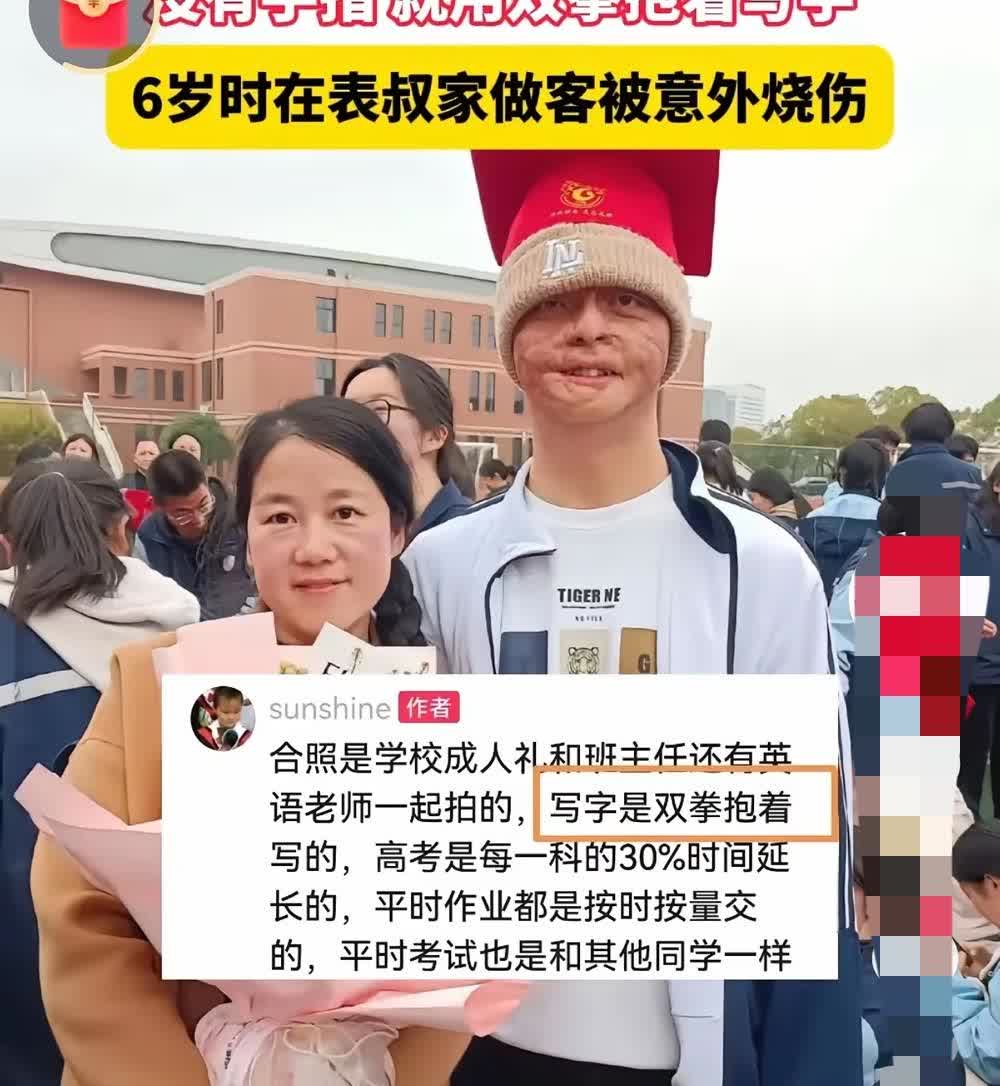 太励志了被烧伤男孩方益凡高考664分恭喜这个小伙子[鼓掌][鼓掌]1