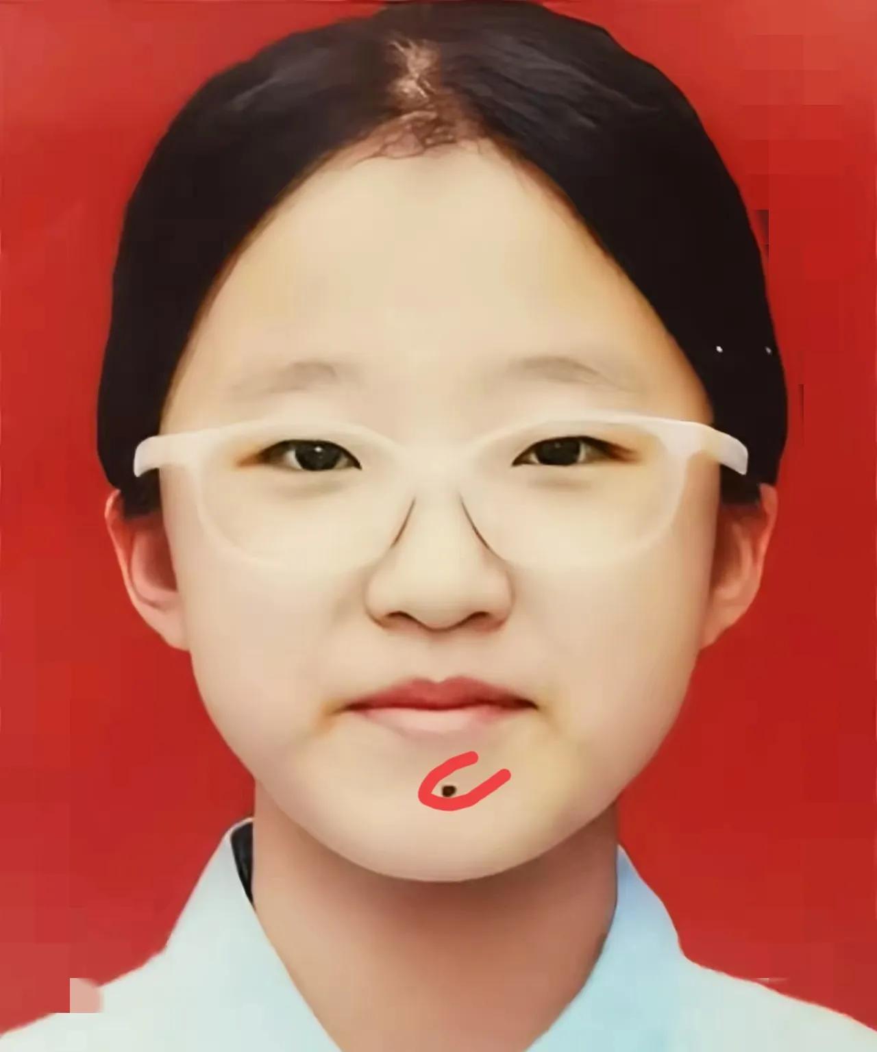 家人们，碰上这事你们会咋选？孙女突然说暑假想把下嘴唇正中央的胎痣去掉，可把我和