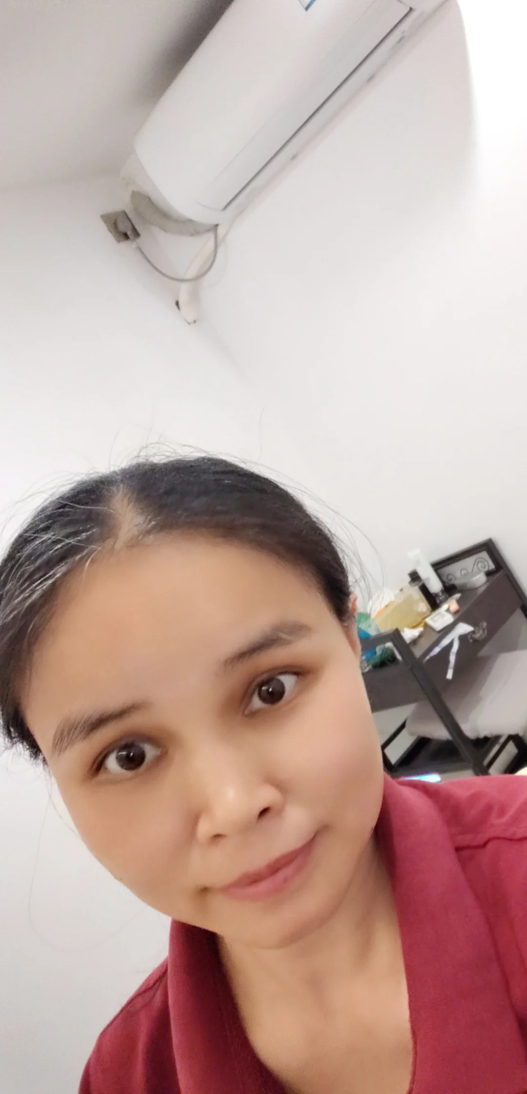 一个月之后头发长了