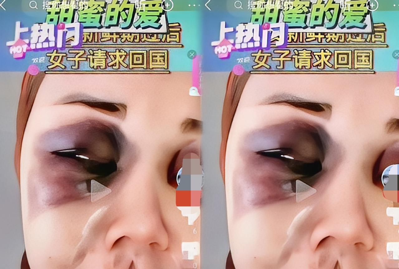 这位留学生在国外被男友暴打，她在社交媒体上发文似乎更想要同情，当初爱的天昏地