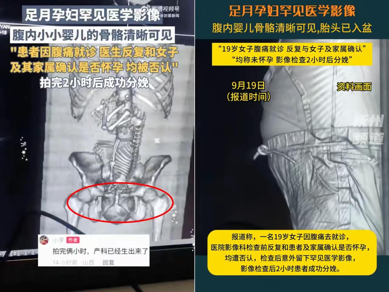 19岁姑娘捂着肚子喊疼冲进医院，​医生反复追问“是不是怀孕了”，​她和家属拍